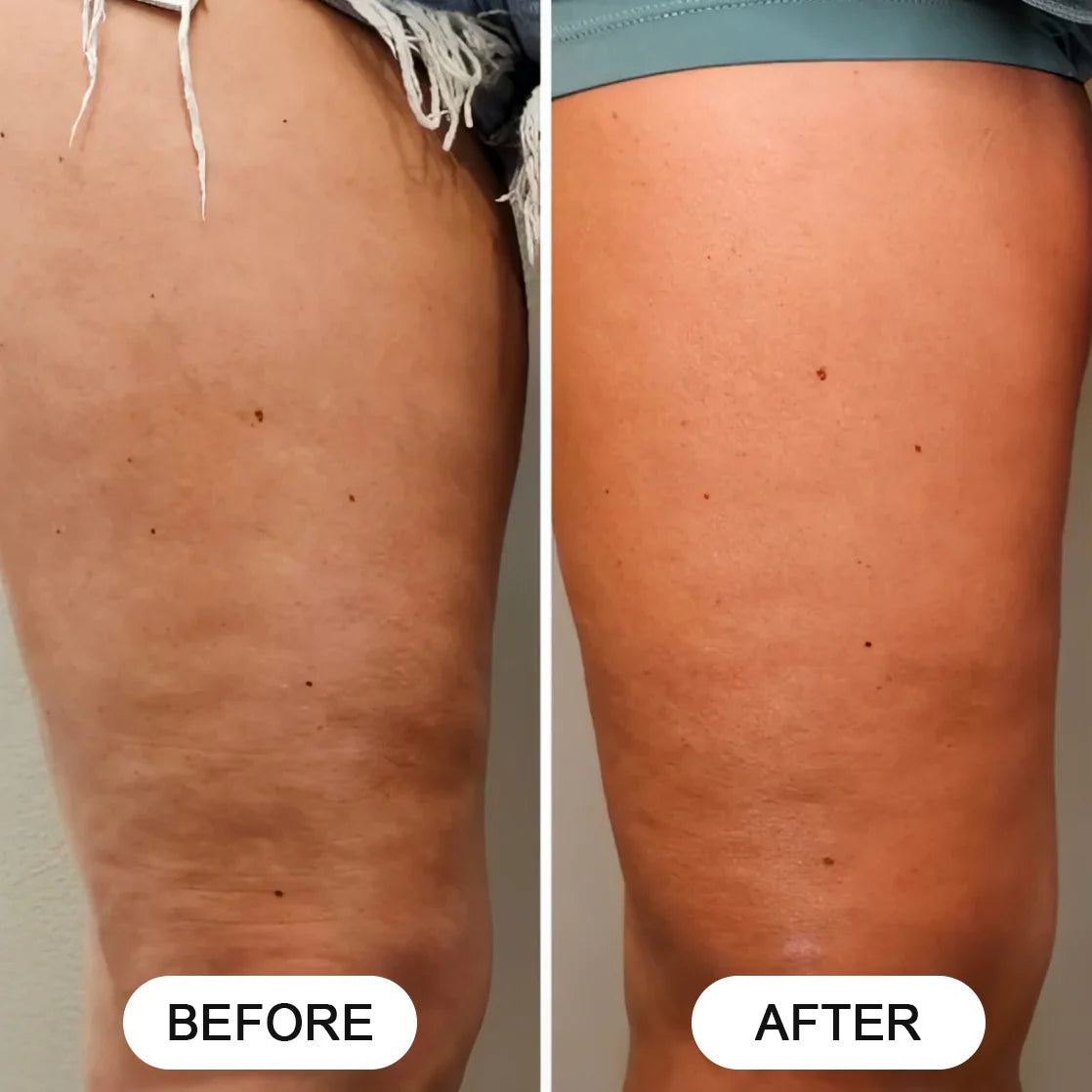 Siluva Pro™ – Verminder Cellulite & Verstevig Je Huid in Slechts 10 Minuten Per Dag!