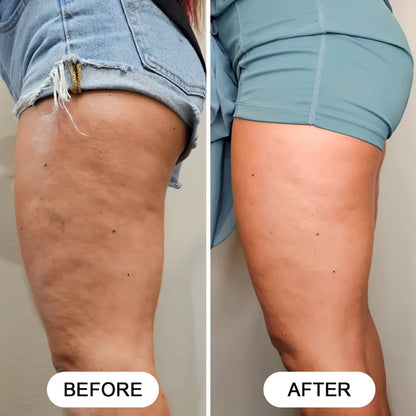 Siluva Pro™ – Verminder Cellulite & Verstevig Je Huid in Slechts 10 Minuten Per Dag!