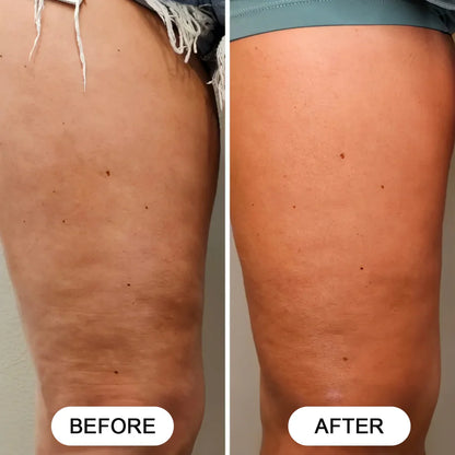 Siluva Pro™ – Verminder Cellulite & Verstevig Je Huid in Slechts 10 Minuten Per Dag!